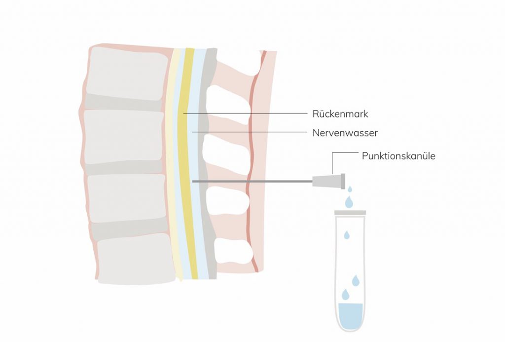 Grafik zu Rückgrat und Rückenmark